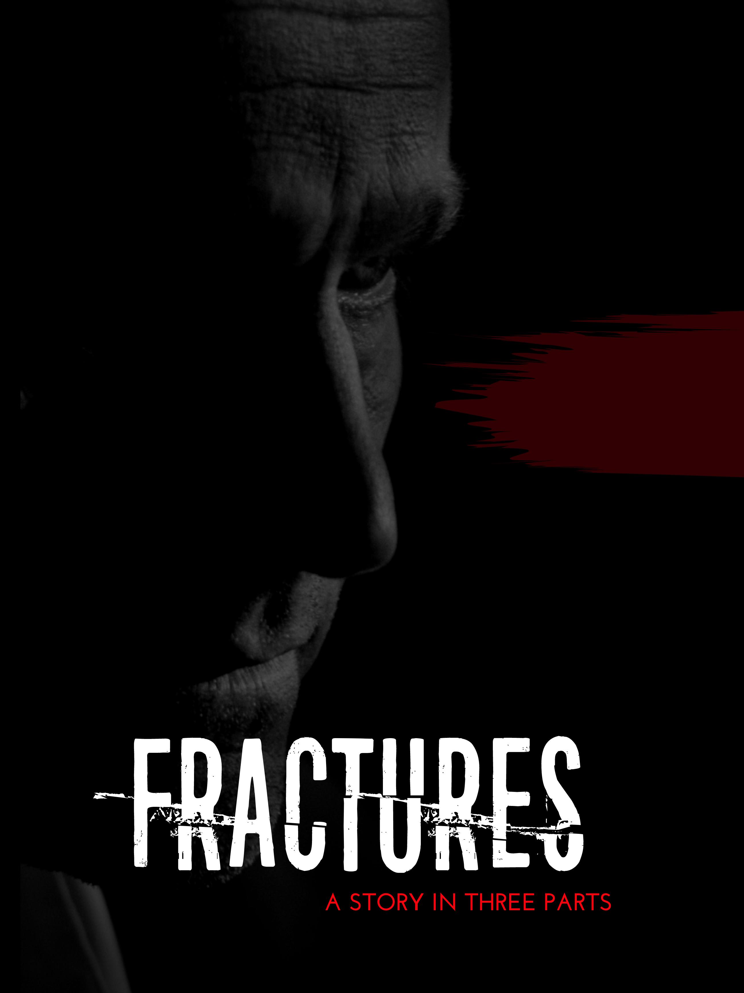 Fractures: A Story in Three Parts